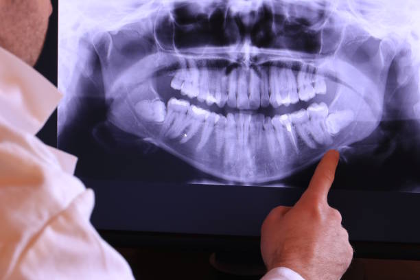 Best Urgent Dental Care in Montegut, LA