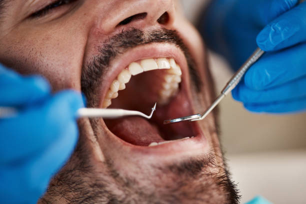 Best Same-Day Emergency Dentist in Montegut, LA