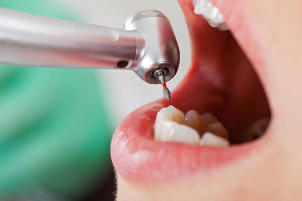Best Emergency Dental Surgery in Montegut, LA